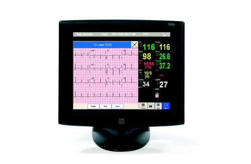 Patient Monitor - ECG Screen Shot